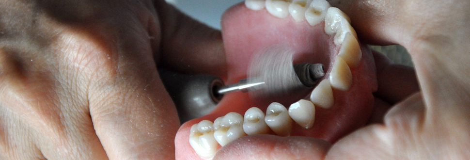 Reparaturen über Ihren Zahnarzt!